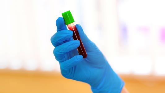 hemophilia b treatment