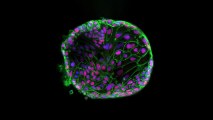 prevent COVID-19