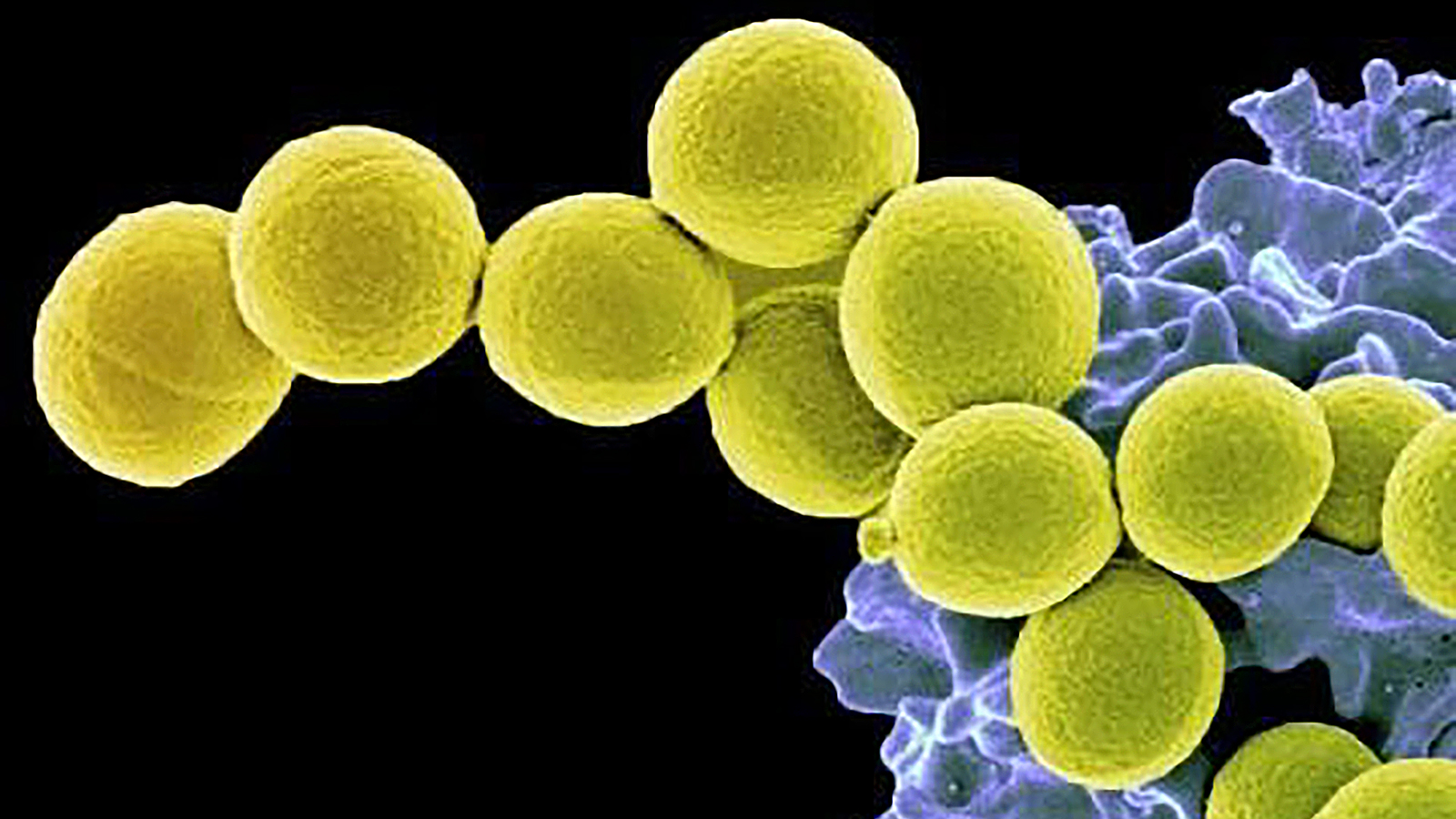 Staphylococcus aureus 4