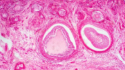 an image of an ovary under a microscope