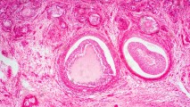 an image of an ovary under a microscope