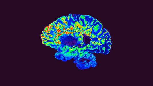 a colorful brain scan
