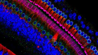 saç hücrelerinin mikroskop altında renkli bir görüntüsü www.cafemedyam.com 