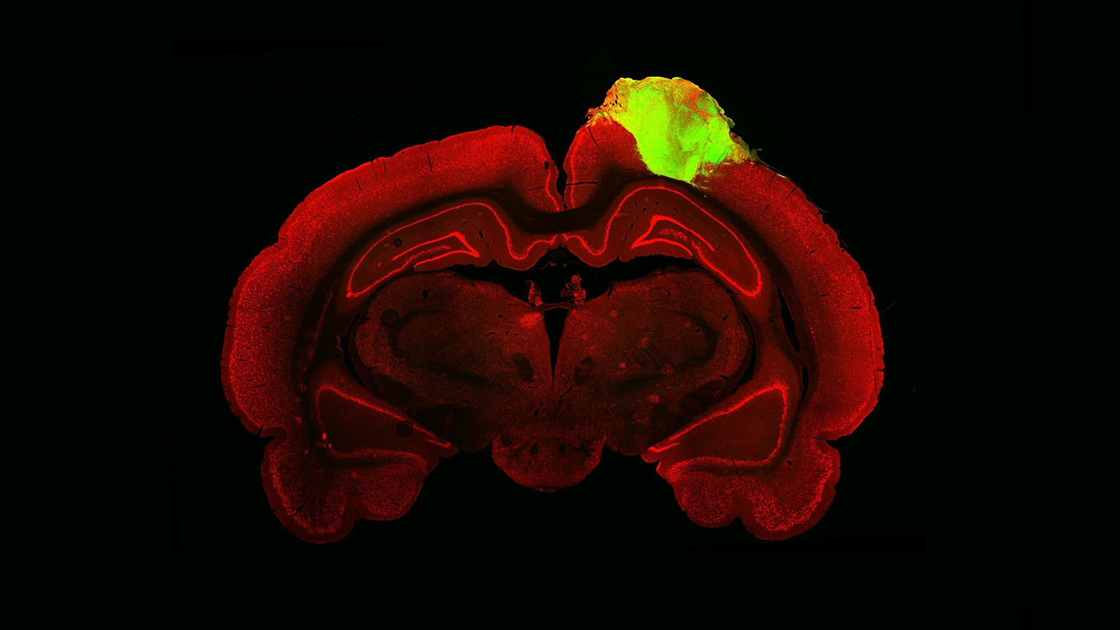 an image of a rat brain with a grafted human brain organoid