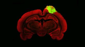 an image of a rat brain with a grafted human brain organoid