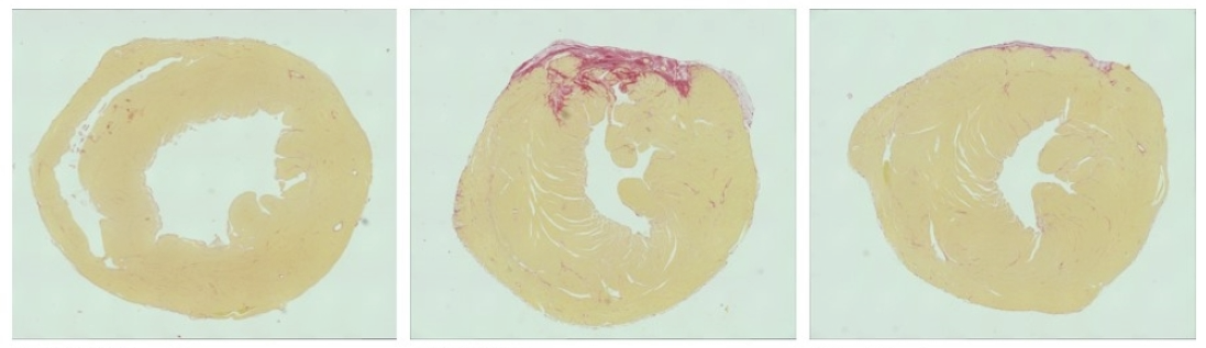 three mouse hearts with varying levels of damage