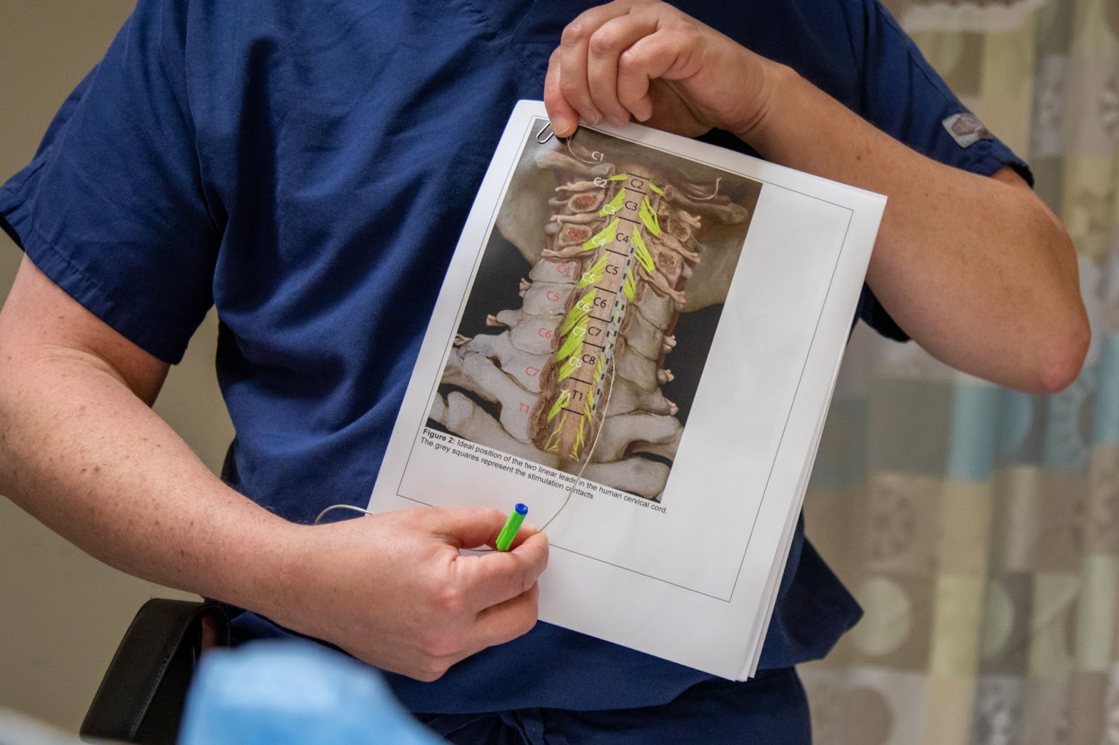 a doctor pointing at the location of electrodes in an image of a neck skeleton
