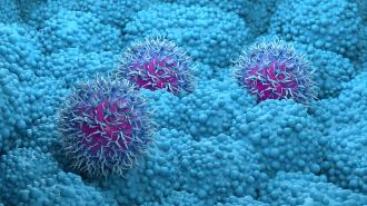 a rendering of pancreatic cancer cells
