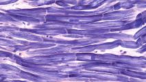 purple-stained microscopic view of heart muscle tissue