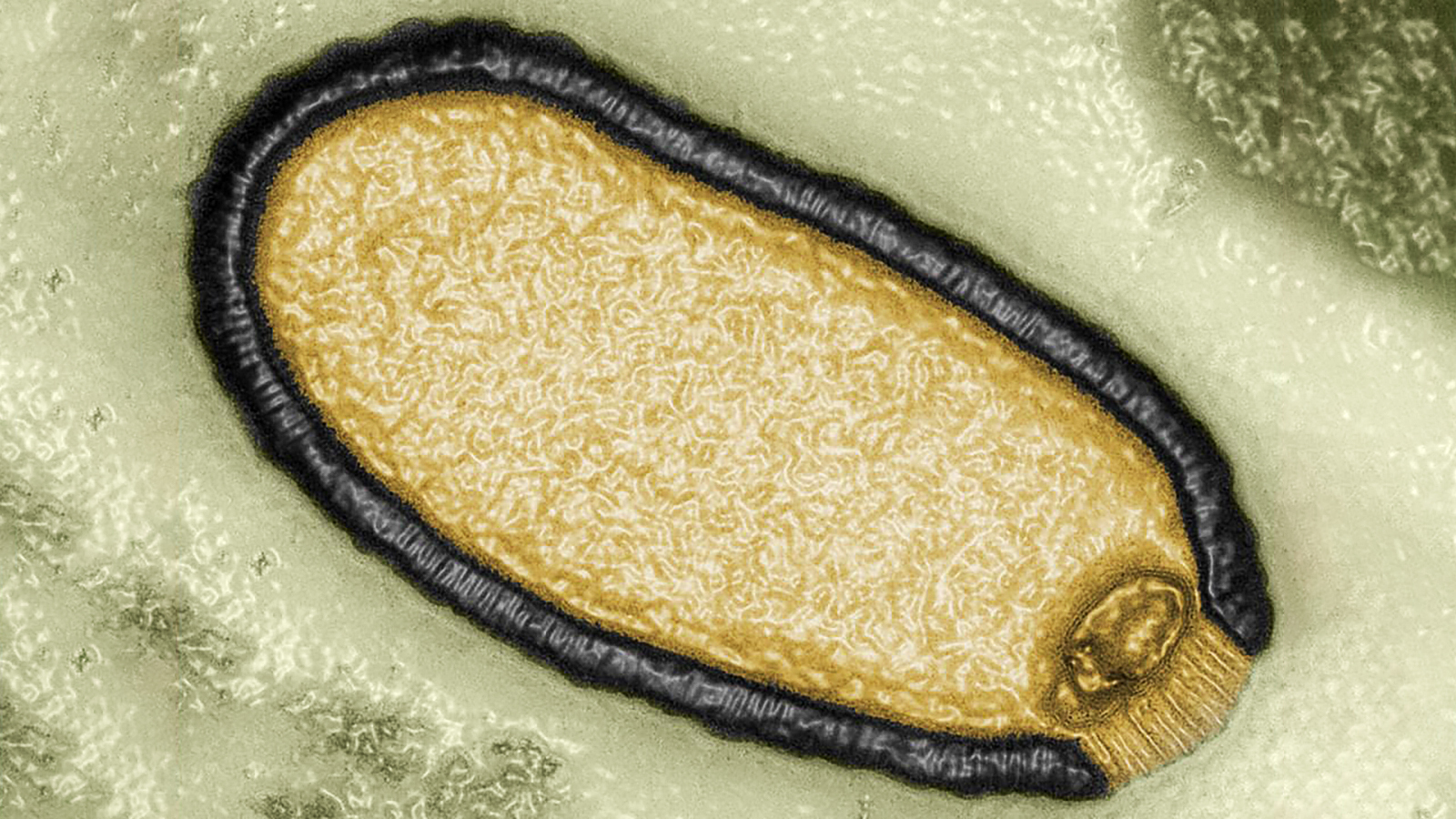 “Zombie virus” revived after 48,500 years in permafrost