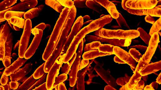 a microscope image of tuberculosis bacteria