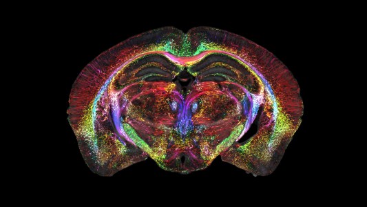a colorful scan of a mouse brain