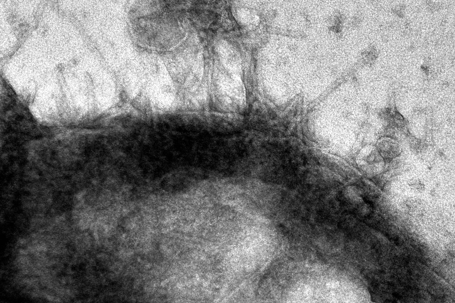 “Nanosyringes” can inject drugs right into a single cell