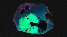 an image of a mouse brain under a microscope. one part of the brain is brighter than the rest.