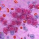 an illustration of cancer cells floating alongside blood cells