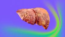 a diseased human liver on a colorful background