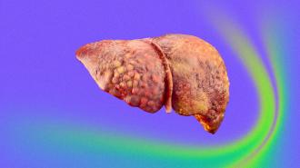 a diseased human liver on a colorful background