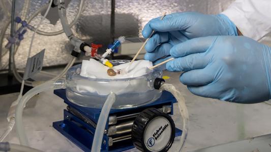 a person in blue gloves is manipulating a small organ in a petri dish