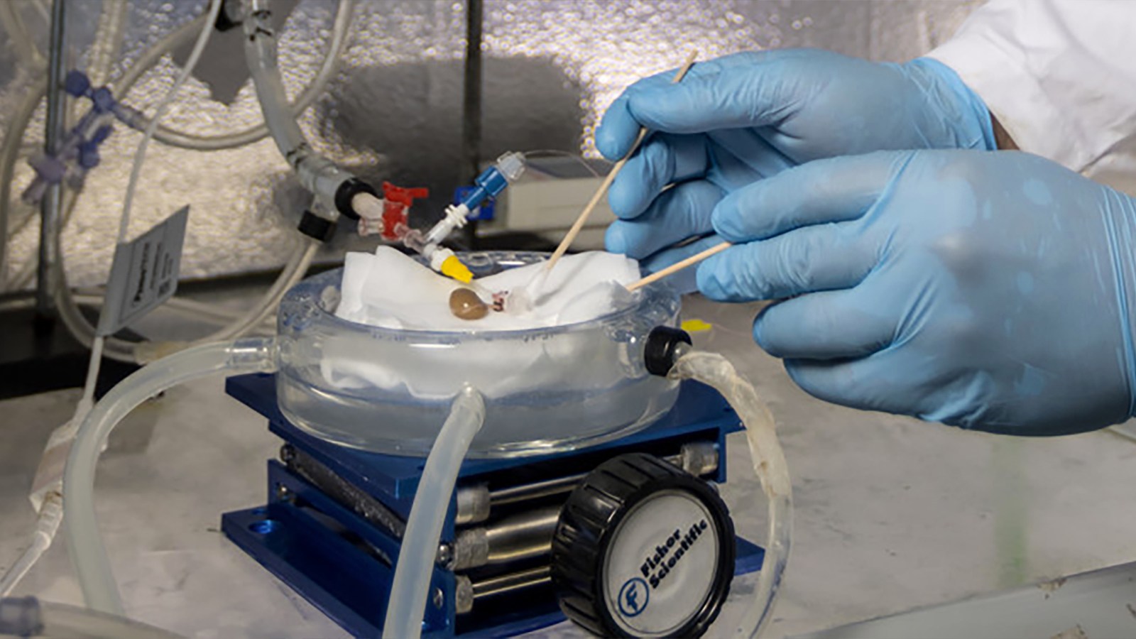 Cryogenically frozen organs successfully transplanted into rats