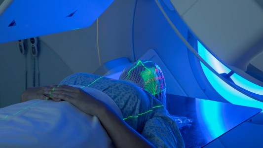 radiation therapy patient