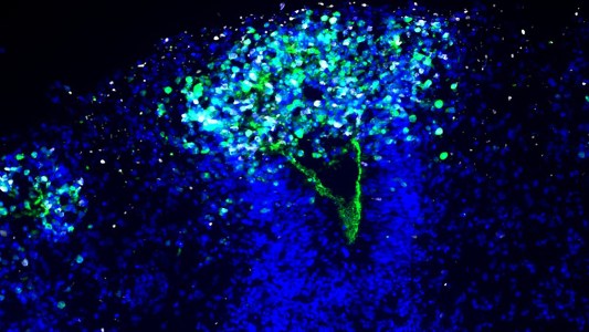 An image of a brain organoid depicting herpes encephalitis