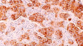 a close up of a cell with brown and white cells.