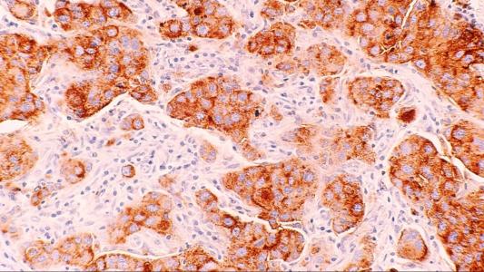 a close up of a cell with brown and white cells.
