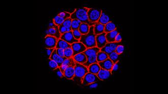 An image depicting cellular activity with blue and red lights, used for assessing the risk of pancreatic cancer.