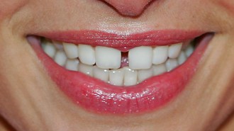 A close up of a woman's teeth showcasing remarkable ability to regenerate.