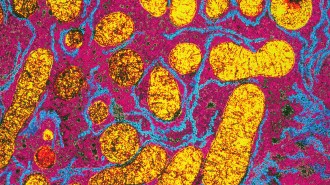 A close up of liver cells