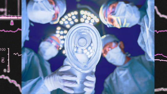 An image of surgeons performing brain surgeries.