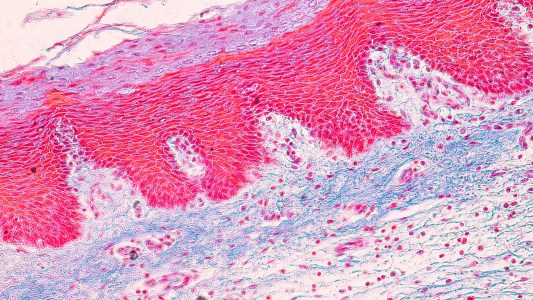 A close up of a body fat tissue.