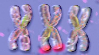 Three fragile x syndrome dna strands on a purple background.