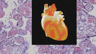 an image of a heart. The background is a microscope image of cells.
