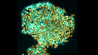 magnified image of ips cells