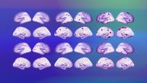 A series of brains on a colorful background