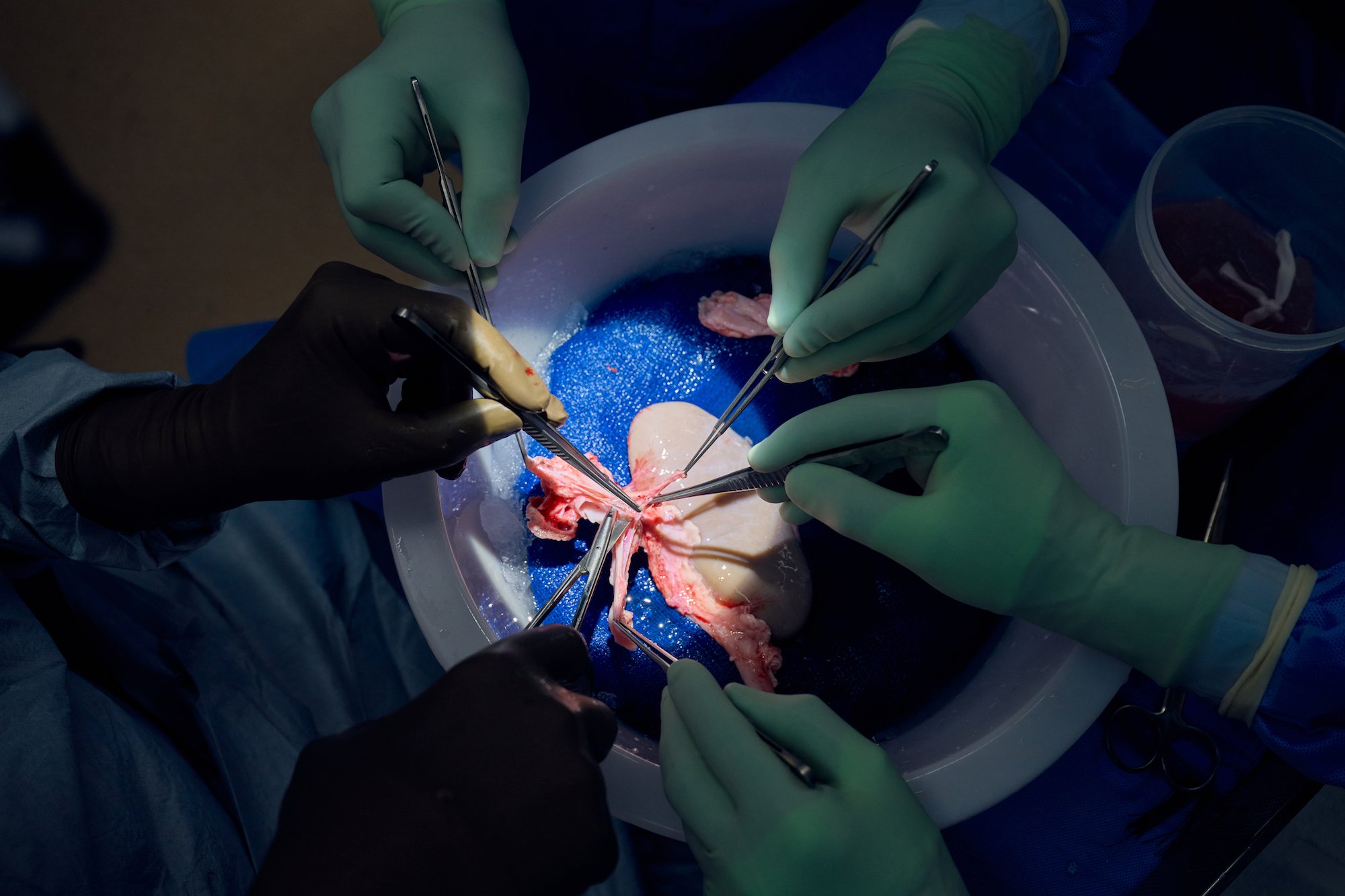 Doctors prepare the pig kidney for the transplant surgery.