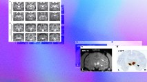 brain scan images on a colorful background