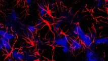 a close up of astrocytes, shown as red streaks, in the brains of mice