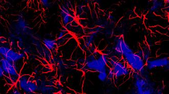 a close up of astrocytes, shown as red streaks, in the brains of mice