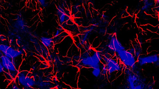 a close up of astrocytes, shown as red streaks, in the brains of mice
