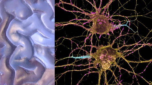 an image of neurons next to a stylized image of the surface of the brain