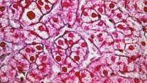 A close up image of a pink liver cells