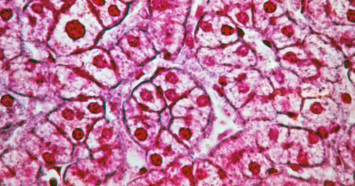 New obesity cure slashes excess weight of mice on fatty, sugary diet plan