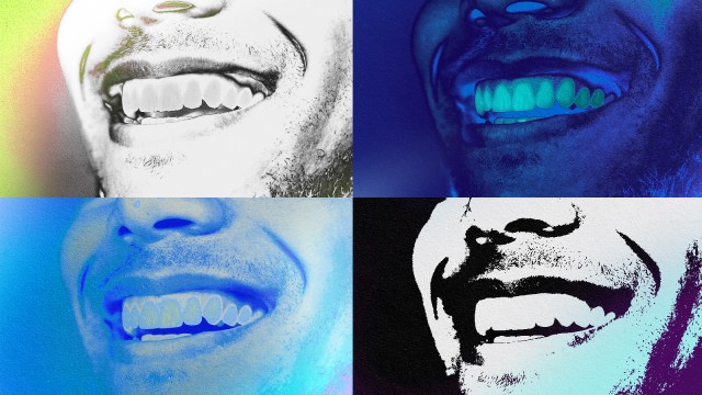Four pictures of a man's teeth in different colors depicting tooth decay.