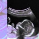 An ultrasound image of a premature baby.