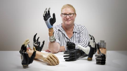 A woman with a bionic hand is posing from behind a table with a bunch of bionic hands on it
