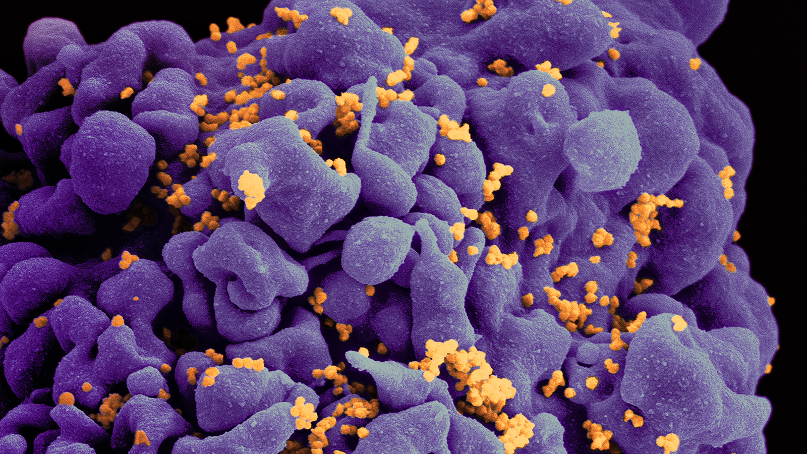 An HIV infected cell