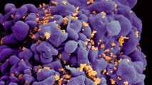 An HIV infected cell