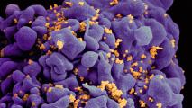 An HIV infected cell